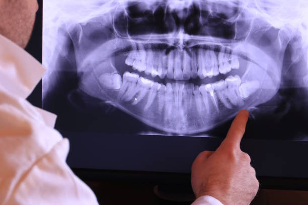Best Emergency Care for Gum Disease in Ome, GA